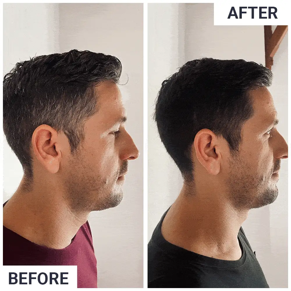 NOVA HAIR rezultat